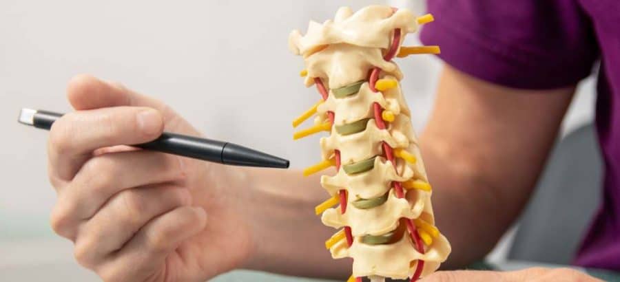 Spondilite anchilosante invalidità