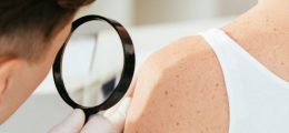 invalidità civile per melanoma